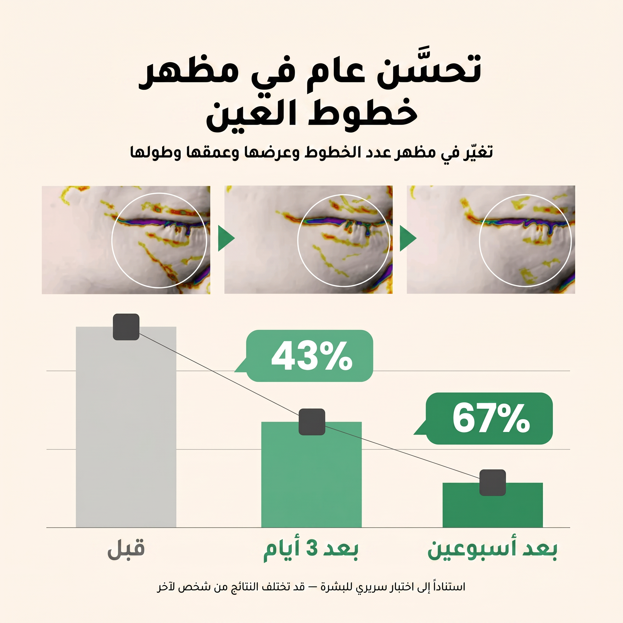 سيروم Axis-Y بالكولاجين النباتي لمنطقة تحت العين